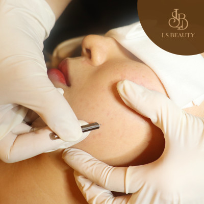 Combo 2 lần chăm sóc da mụn thuần hữu cơ gồm soi da, nặn mụn và làm dịu da 