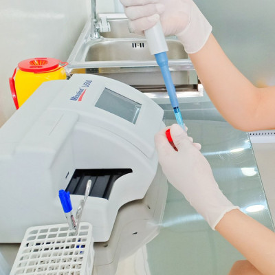 Gói khám tầm soát bệnh tiểu đường tại phòng khám đa khoa quốc tế Golden Healthcare