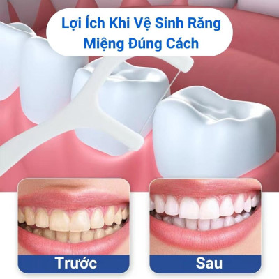 Phụ kiện nhà bếp phòng ăn _ Set  hộp 50 cây tăm chỉ nha khoa , an toàn dễ sử dụng 