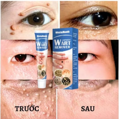 HỘP KEM BÔI TRỊ HẾT MỤN CÓC NÚT RUỒI DA ĐEN SẠM THUẬN TIỆN CHO MỌI NGƯỜI