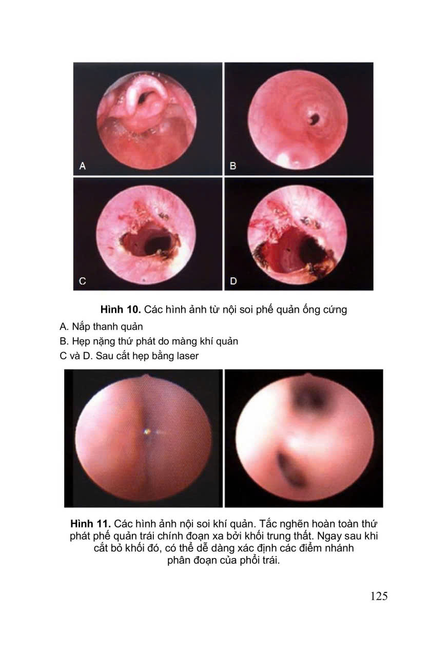 Sách - Cấp cứu hồi sức nhi khoa ( trọn bộ, xuất bản 2025)