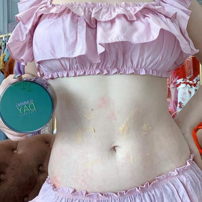 Bộ ủ hỗ trợ giảm mỡ mờ rạn Slimming Day Collagen