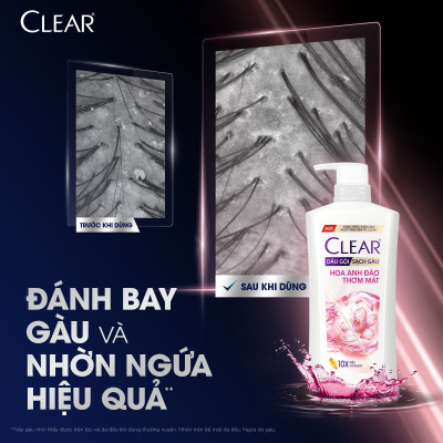 Dầu gội sạch gàu Clear Hoa Anh Đào đánh bay gàu & nhờn ngứa, sảng khoái cả ngày dài 630G