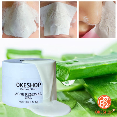 Gel Lột Mụn OKESHOP 30ml - Giải Pháp Loại Bỏ Mụn Đầu Đen - Mụn Cám - Bạ Nhờn - Làm Sạch Sâu Và Thu Nhỏ Lỗ Chân Lông