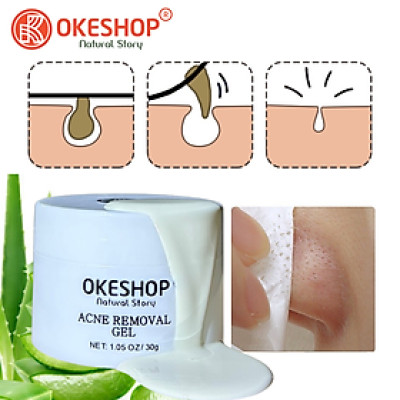 Gel Lột Mụn OKESHOP 30ml - Giải Pháp Loại Bỏ Mụn Đầu Đen - Mụn Cám - Bạ Nhờn - Làm Sạch Sâu Và Thu Nhỏ Lỗ Chân Lông