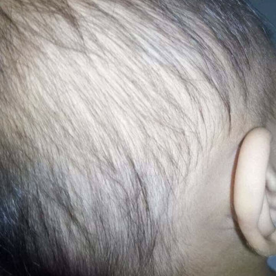 SỮA TẮM LÁ KHỔ QUA RỪNG MẸ KEN-CHAI 500ML