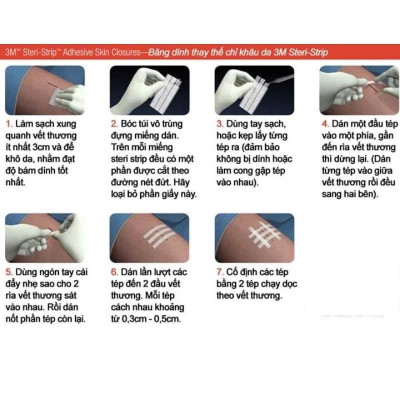 Miếng dán thay chỉ khâu da Steri-Strip R1546  6mm x 100mm (1/4IN x 4IN)
