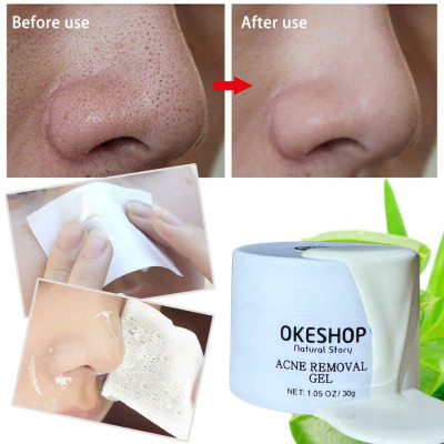 Gel Lột Mụn OKESHOP 30ml - Giải Pháp Loại Bỏ Mụn Đầu Đen - Mụn Cám - Bạ Nhờn - Làm Sạch Sâu Và Thu Nhỏ Lỗ Chân Lông