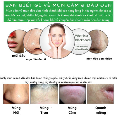 Gel Lột Mụn OKESHOP 30ml - Giải Pháp Loại Bỏ Mụn Đầu Đen - Mụn Cám - Bạ Nhờn - Làm Sạch Sâu Và Thu Nhỏ Lỗ Chân Lông