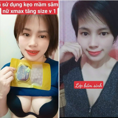 (tặng ủ môi đa năng) 5h kẹo mầm sâm tố nữ xmax Mychi