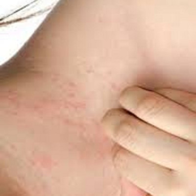 SỮA TẮM LÁ KHỔ QUA RỪNG MẸ KEN-CHAI 100ML