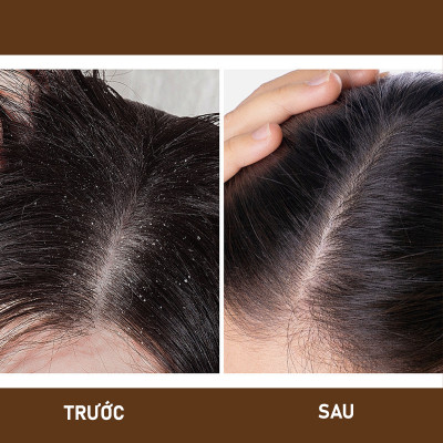 [Thảo Dược Thật] Dầu gội bồ kết, bưởi cô đặc, dầu gội thảo dược phụ hồi tóc, ngăn ngừa gãy rụng - Ngưu Cân Thảo 500ml