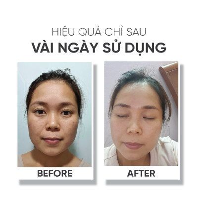 Nước hoa hồng giúp làm sáng da Lá House Lá Care All Natural Toner 200ml/100ml