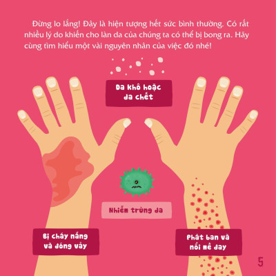 Sách Có Thể Bạn Chưa Biết Vì Sao Chúng Ta - Vì Sao Chúng Ta Bị Bong Da
