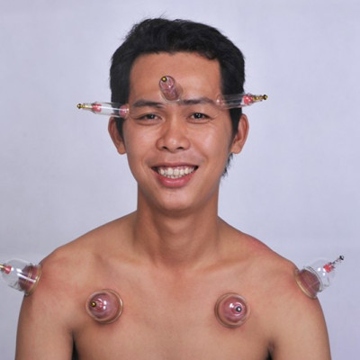 Bộ Giác Hơi Không Dùng Lửa Duy Thành YGH05 (6 ống giác)