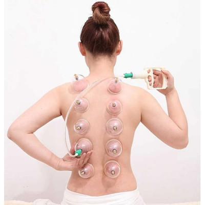 Bộ giác hơi không lửa 24 ly, Bộ giác hơi 24 cốc loại tốt - Hàng Chính Hãng [Được đồng kiểm]