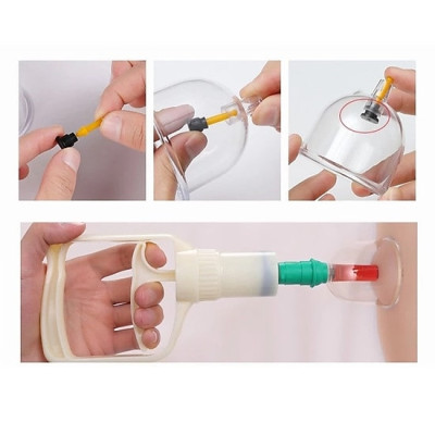 Bộ giác hơi không lửa 24 ly, Bộ giác hơi 24 cốc loại tốt - Hàng Chính Hãng [Được đồng kiểm]