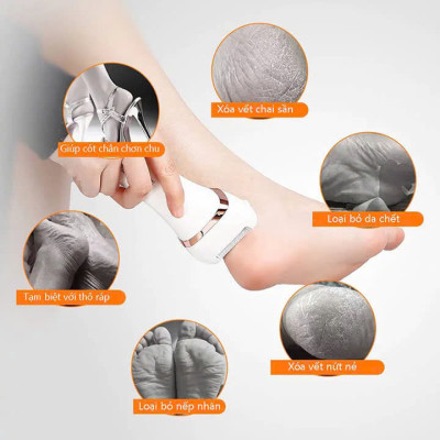 Máy chà gót chân tẩy tế bào ch.ết làm mềm sáng gót chân chuyên dụng tại nhà Chuyên Nghiệp Dùng Trong Spa Nail Rock Foot Callus remover Giao Màu Ngẫu Nhiên
