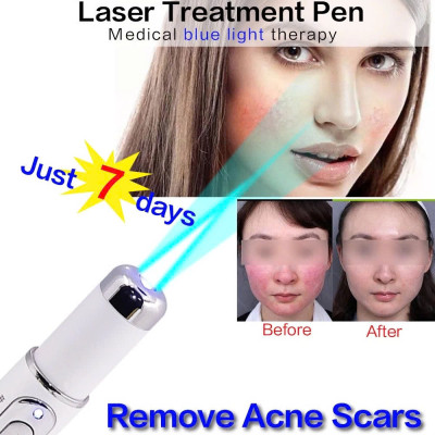 Máy LASER tẩy mụn và xóa sẹo với ánh sáng xanh thần kỳ: Giải pháp thông minh an toàn
