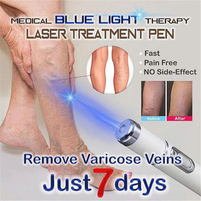 Máy LASER tẩy mụn và xóa sẹo với ánh sáng xanh thần kỳ: Giải pháp thông minh an toàn