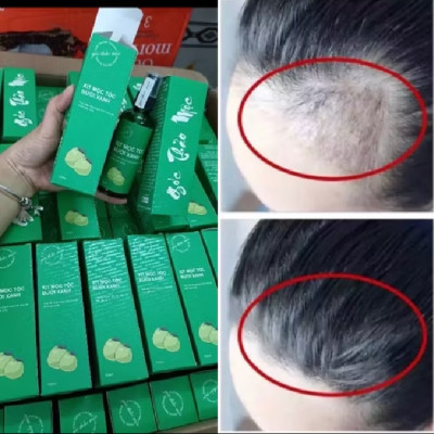 tinh dầu bưởi xịt kích thích mọc tóc loại tốt 
